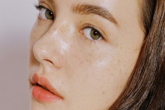 Trị nám bằng nguyên liệu tự nhiên có hiệu quả không?